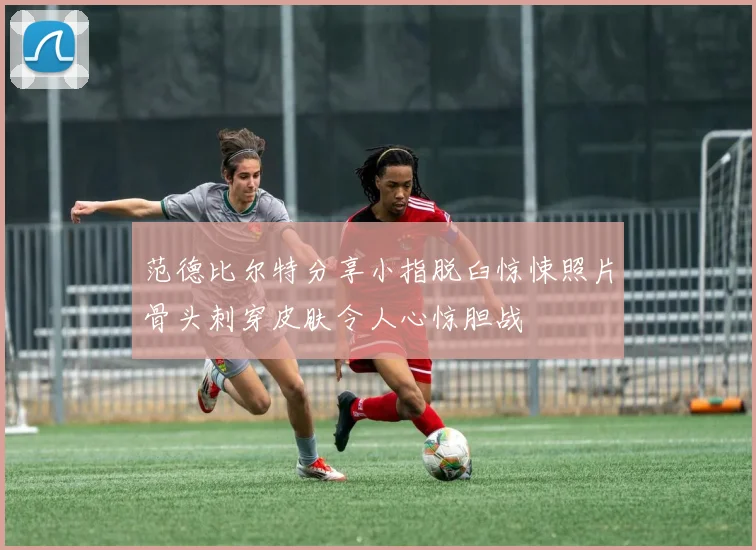 范德比尔特分享小指脱臼惊悚照片骨头刺穿皮肤令人心惊胆战